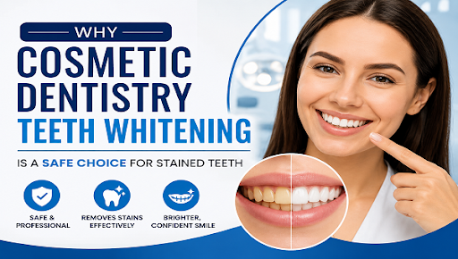 Teeth Whitening for Stained Teeth Safe Cosmetic Whitening